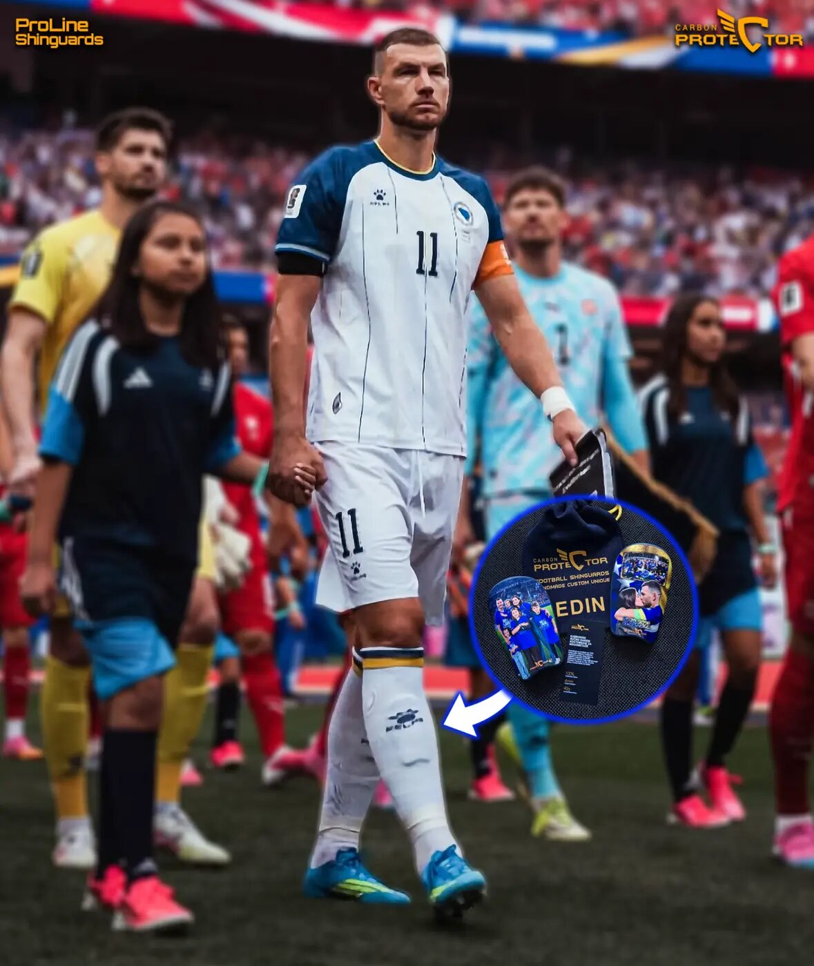 Edin Džeko s Carbon Protector kostobranima